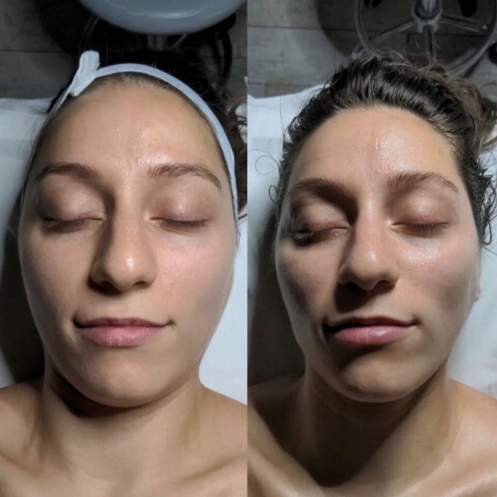 Gua Sha Sculpting Facial Before and After